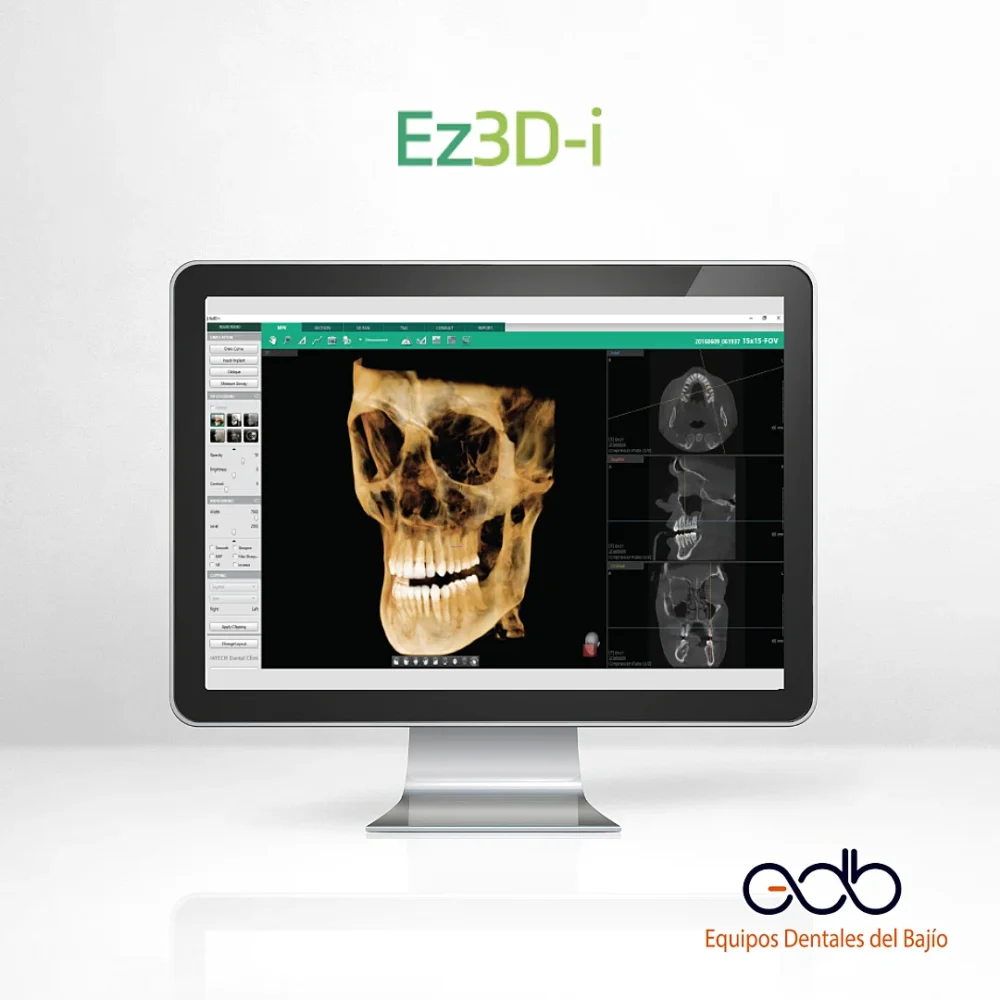Ez3D-i vatech software de imágenes 3D rápido y fácil