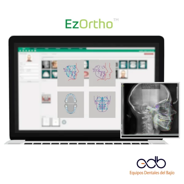EzOrtho- Software TODO EN UNO para ortodoncia